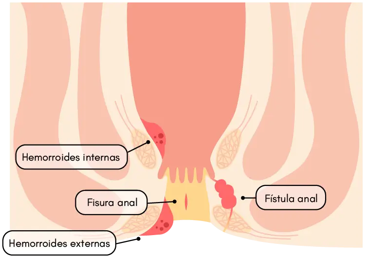 Cirugía Especializada